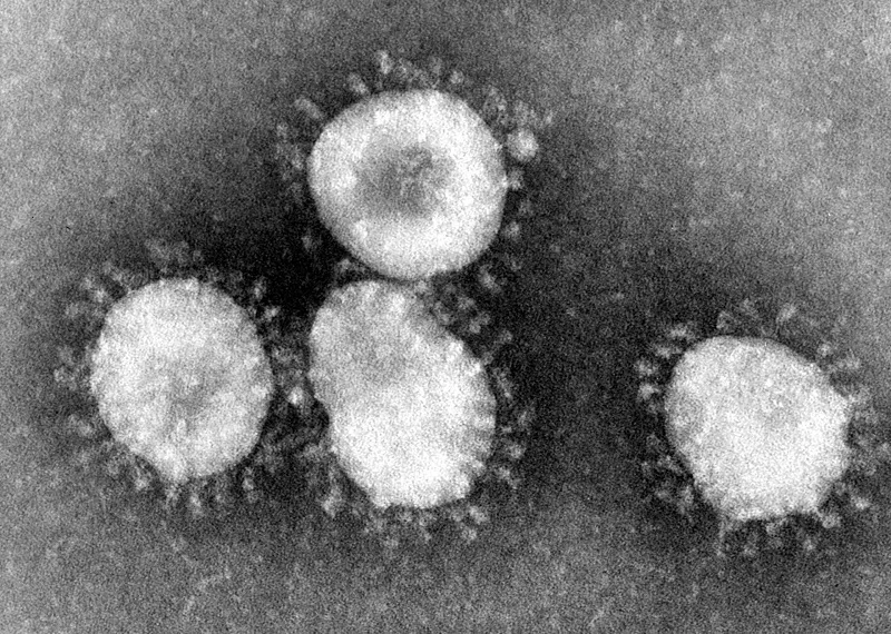 US CDC develops comprehensive plan to screen passengers to combat deadly virus.